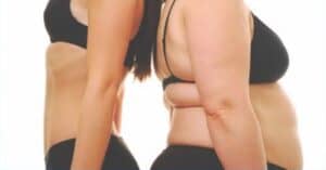 Diapositiva29 obesità
